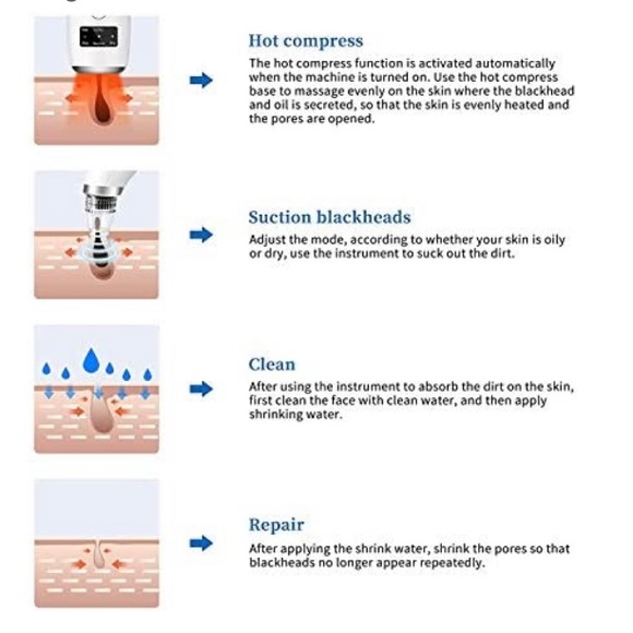 Facial Blackhead Remover Pore Vacuum -Pore Cleaner 5 Suction, Rechargeable - Picture 4 of 15